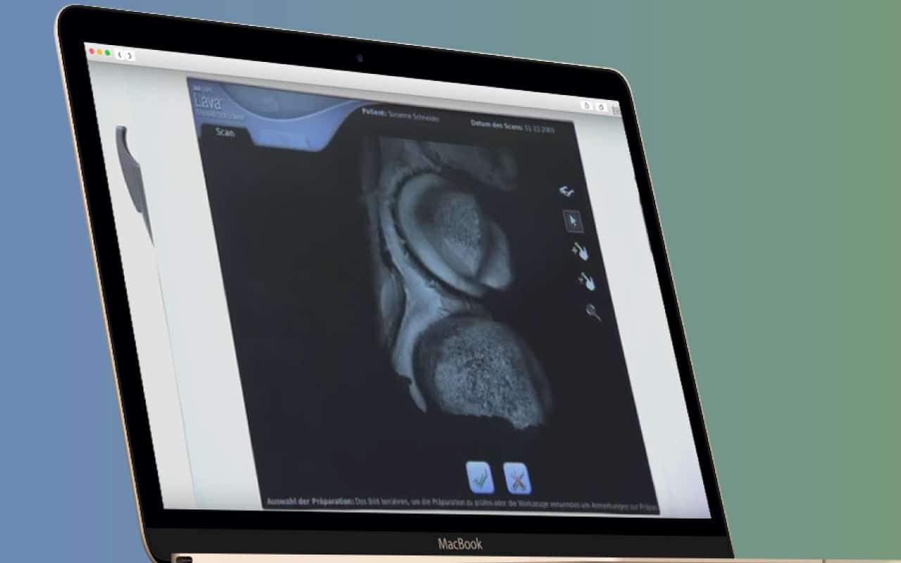 3D Dental Application
