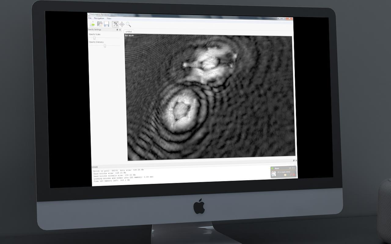 3D Volumetric Microorganism Viewer