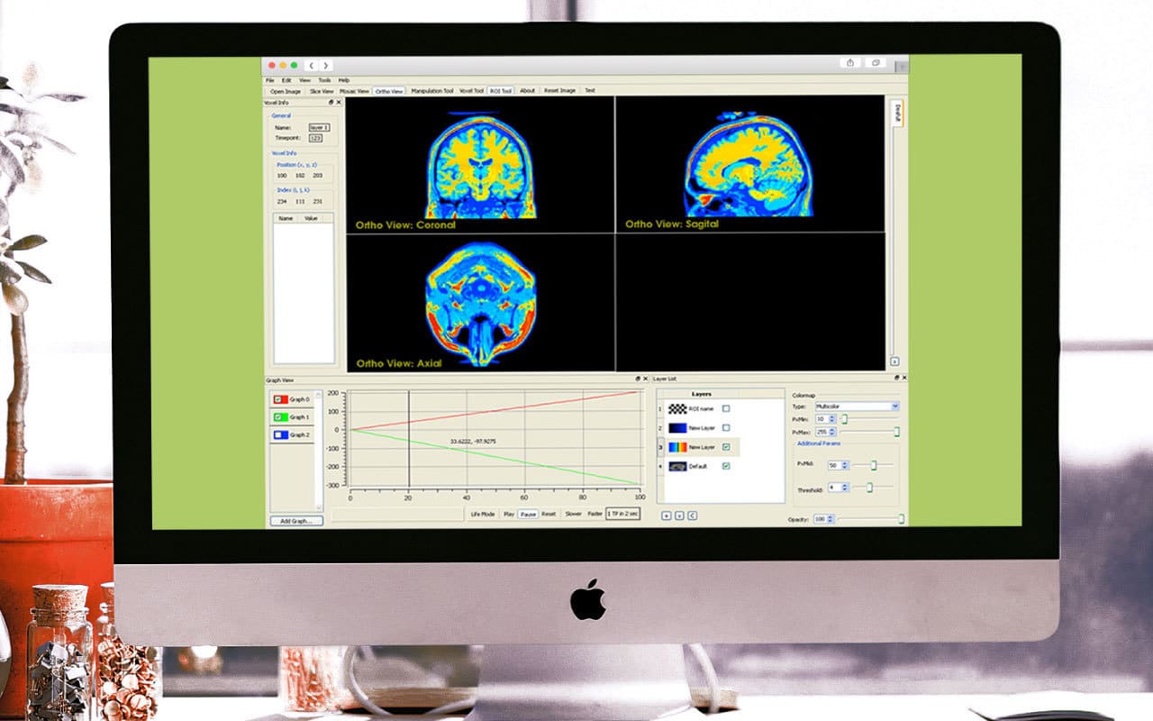 MRI Imaging Research Application