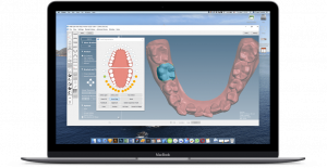 AI-powered dental imaging software interface for orthodontic analysis and treatment planning