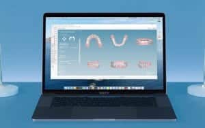 3D orthodontic dental CAD/CAM custom desktop application interface design