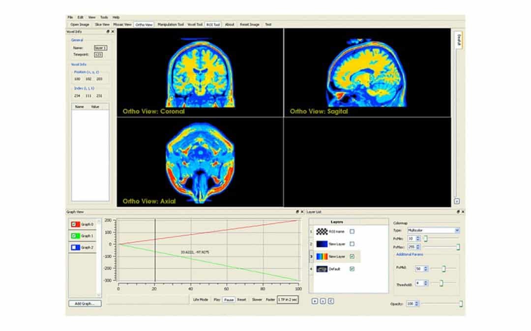 MRI Imaging Research Application