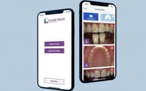 ShadeWave Mobile app interface showcasing dental healthcare features on iOS device