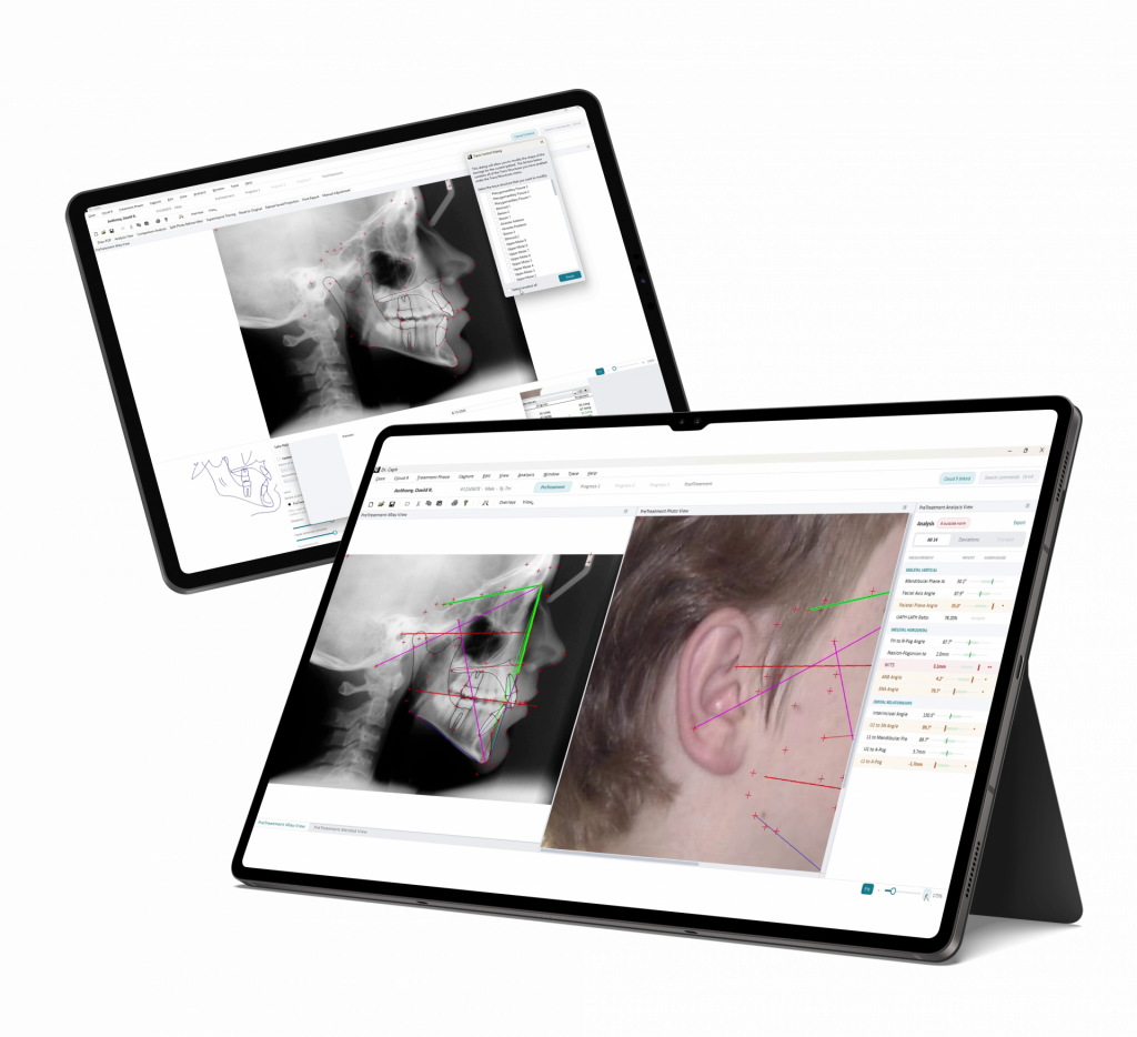 Dr. Ceph interface showing cephalometric X-ray tracing, facial analysis, and orthodontic measurements.