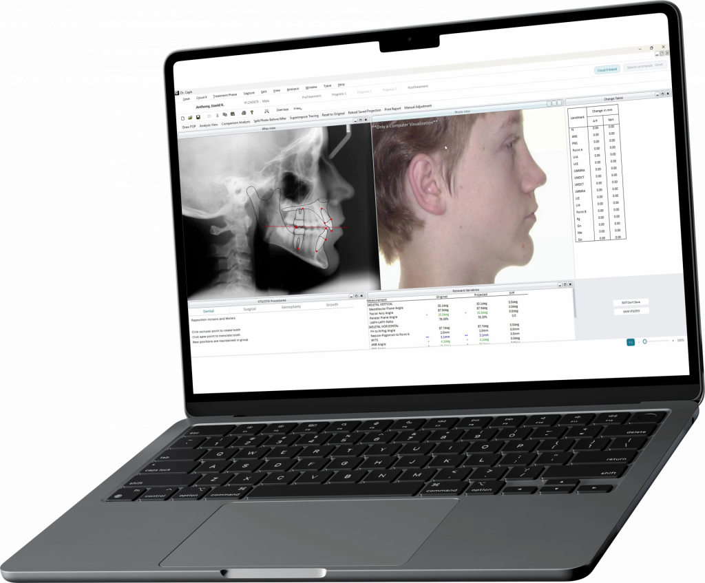 Legacy Dr. Ceph workspace with separate X-ray, facial photo, procedure, and measurement panels.
