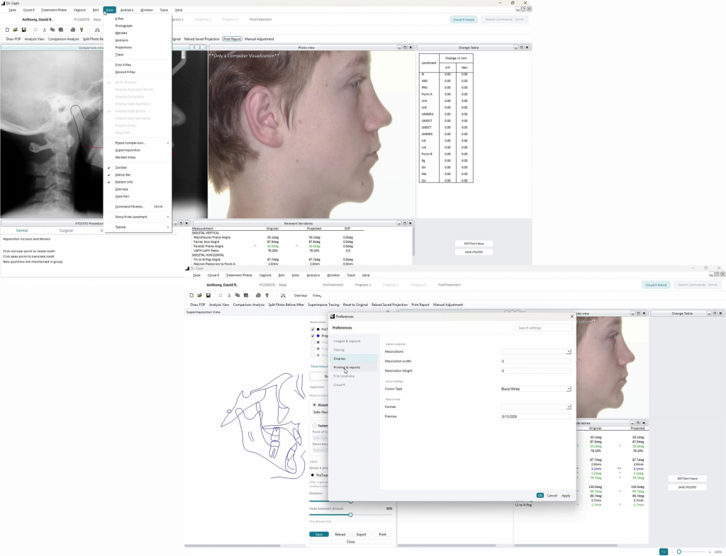 Modernized Dr. Ceph interface showing the View menu and searchable Preferences dialog.